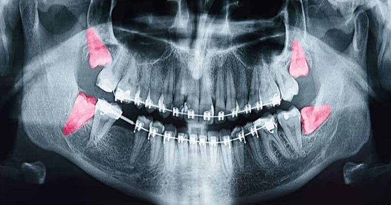 oral and maxillofacial pathology