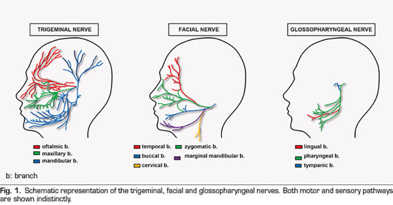 orofacial pain