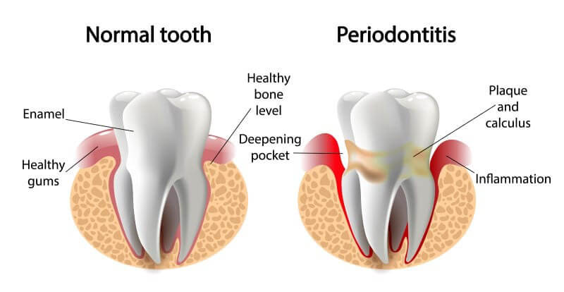 periodontist