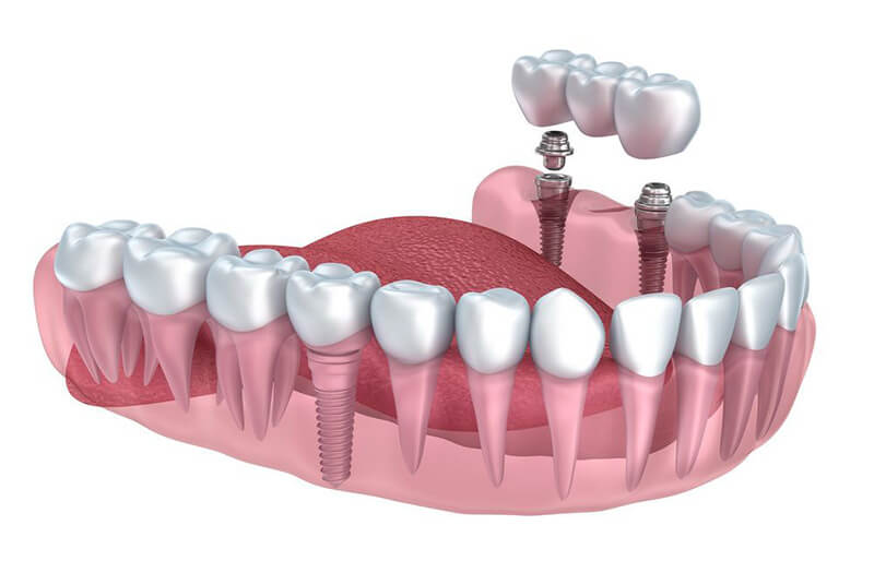 prosthodontist